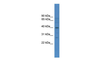 SOX1 Rabbit Polyclonal Antibody