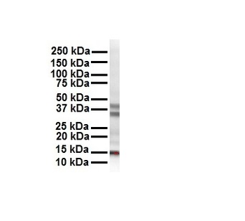 CITED2 Rabbit Polyclonal Antibody