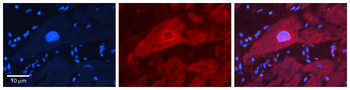IRF6 Rabbit Polyclonal Antibody