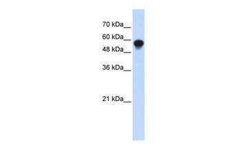 IRF6 Rabbit Polyclonal Antibody