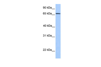 NR4A2 Rabbit Polyclonal Antibody
