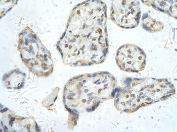 PPARD Rabbit Polyclonal Antibody