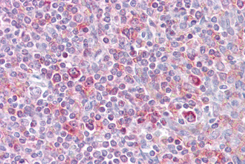 RELB Rabbit Polyclonal Antibody
