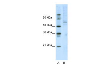ATF7 Rabbit Polyclonal Antibody