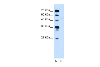 RXRG Rabbit Polyclonal Antibody