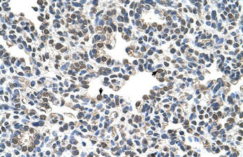 CIZ1 Rabbit Polyclonal Antibody