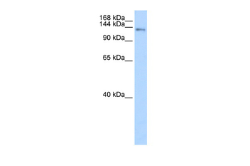 CIZ1 Rabbit Polyclonal Antibody