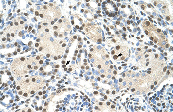 AKAP8L Rabbit Polyclonal Antibody
