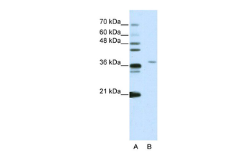 SART3 Rabbit Polyclonal Antibody