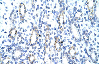 GTF2IRD1 Rabbit Polyclonal Antibody