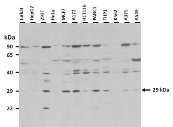 HOXA5 Rabbit Polyclonal Antibody