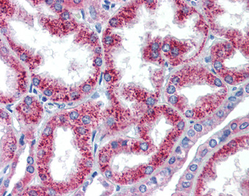 HOXA5 Rabbit Polyclonal Antibody
