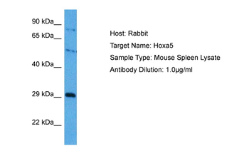 HOXA5 Rabbit Polyclonal Antibody