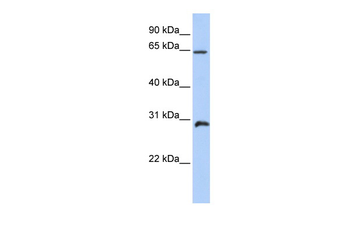 HOXA5 Rabbit Polyclonal Antibody