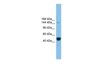 PRDM10 Rabbit Polyclonal Antibody