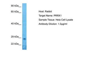 PRRX1 Rabbit Polyclonal Antibody