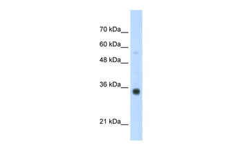 HOXB4 Rabbit Polyclonal Antibody