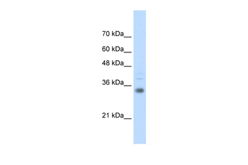 HOXB4 Rabbit Polyclonal Antibody