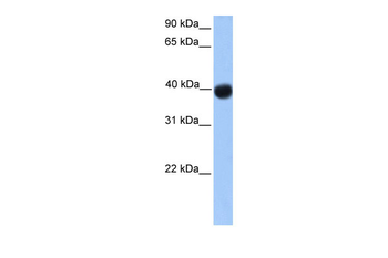 SSBP4 Rabbit Polyclonal Antibody