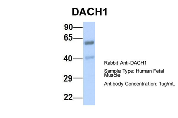 DACH1 Rabbit Polyclonal Antibody