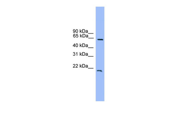 DACH1 Rabbit Polyclonal Antibody