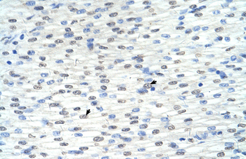 RNF8 Rabbit Polyclonal Antibody