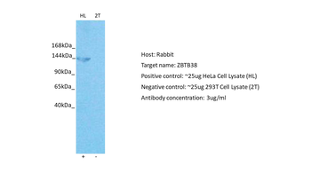 ZBTB38 Rabbit Polyclonal Antibody