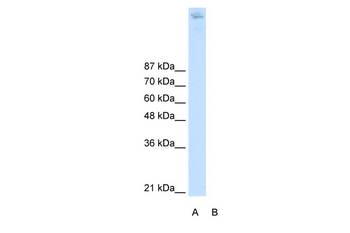 ZBTB38 Rabbit Polyclonal Antibody