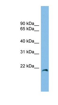 CIRBP Rabbit Polyclonal Antibody