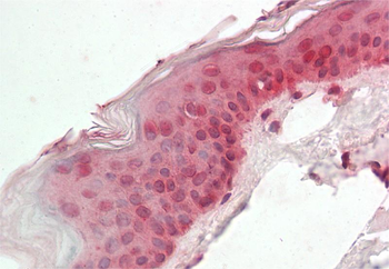 CIRBP Rabbit Polyclonal Antibody