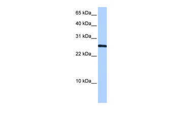 CIRBP Rabbit Polyclonal Antibody