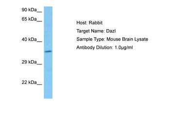 DAZL Rabbit Polyclonal Antibody