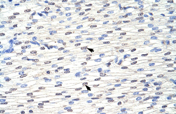 EIF4B Rabbit Polyclonal Antibody
