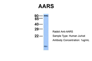 AARS Rabbit Polyclonal Antibody