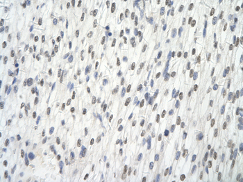 AARS Rabbit Polyclonal Antibody