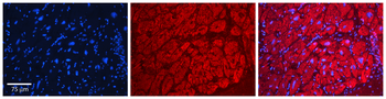 AARS Rabbit Polyclonal Antibody