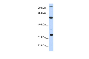 APOBEC1 Rabbit Polyclonal Antibody
