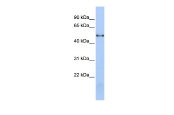 NOVA1 Rabbit Polyclonal Antibody