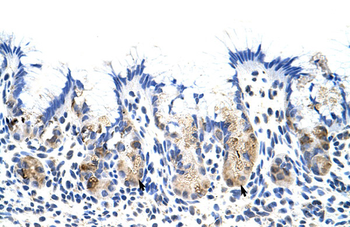 TROVE2 Rabbit Polyclonal Antibody