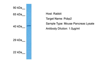 PCBP2 Rabbit Polyclonal Antibody