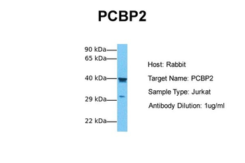 PCBP2 Rabbit Polyclonal Antibody