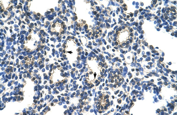 PCBP2 Rabbit Polyclonal Antibody