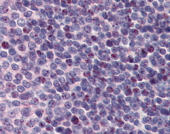 PCBP1 Rabbit Polyclonal Antibody