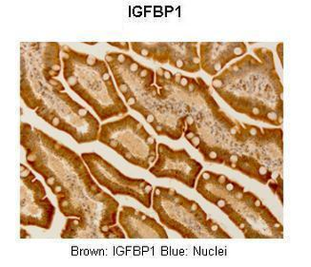 IGF2BP1 Rabbit Polyclonal Antibody