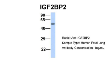IGF2BP2 Rabbit Polyclonal Antibody