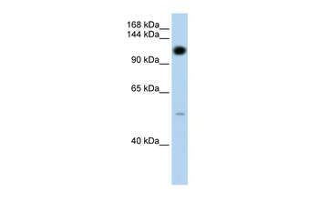 PUM2 Rabbit Polyclonal Antibody