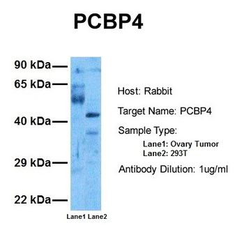 PCBP4 Rabbit Polyclonal Antibody