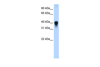 TIA1 Rabbit Polyclonal Antibody