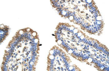 FZD9 Rabbit Polyclonal Antibody