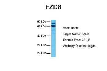FZD8 Rabbit Polyclonal Antibody